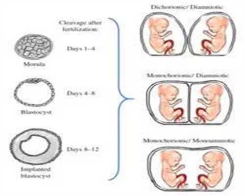 金贝供卵试管的价格_家恩供卵_泰国试管婴儿双胞胎几个月才能够稳定？