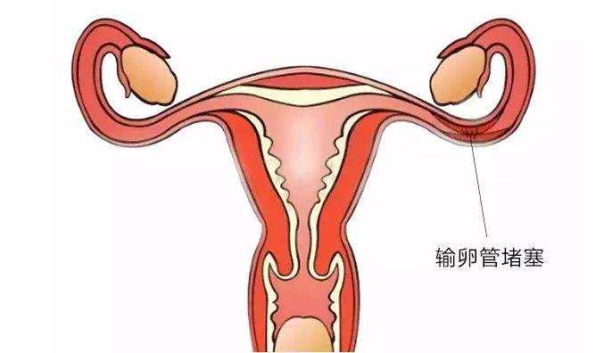 广州试管传承代孕中心 广州供卵试管费用 ‘孕期征兆暗示你生男孩!在左边还是
