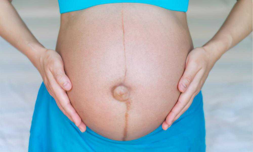 听说孕肚上的黑线可以看胎儿性别，是真的吗？